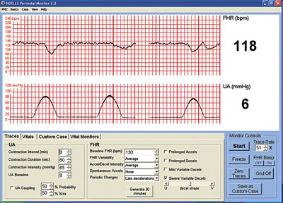 Software complementario p/simulador de partos S552: monitoreo perinatal y generador de escenarios CD501