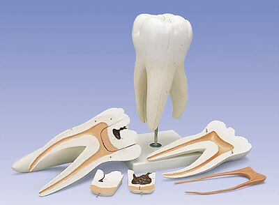 Molar superior, 6 piezas  D15